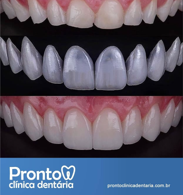 Pronto Clínica Dentária | Dentista Centro de Porto Alegre - foto 3