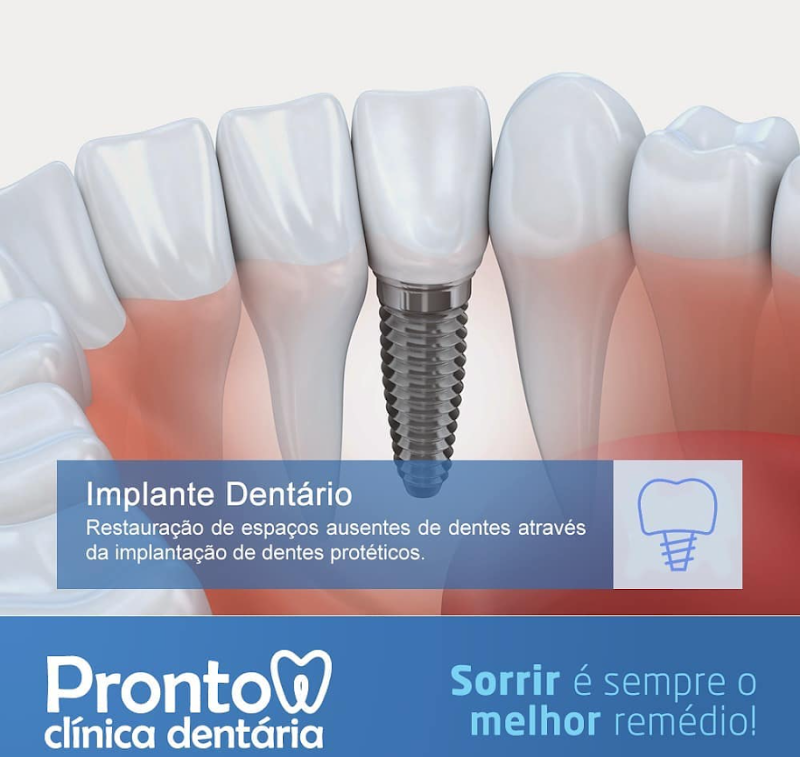 Pronto Clínica Dentária | Dentista Centro de Porto Alegre - foto 4