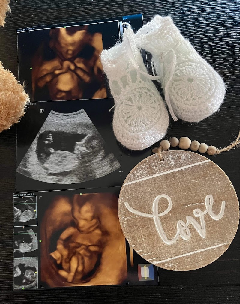 Wonderful Reveals 3D ultrasound maternity & newborn photography SI& NJ