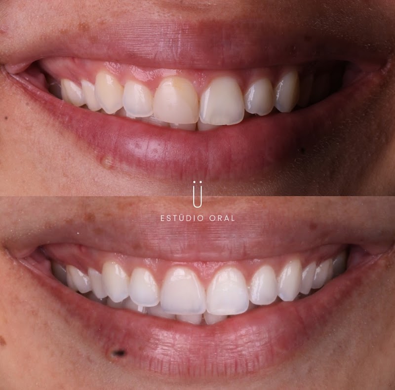 Estúdio Oral Clínica Odontológica | Implantes dentários | Invisalign | Dentista Pampulha - BH - foto 2