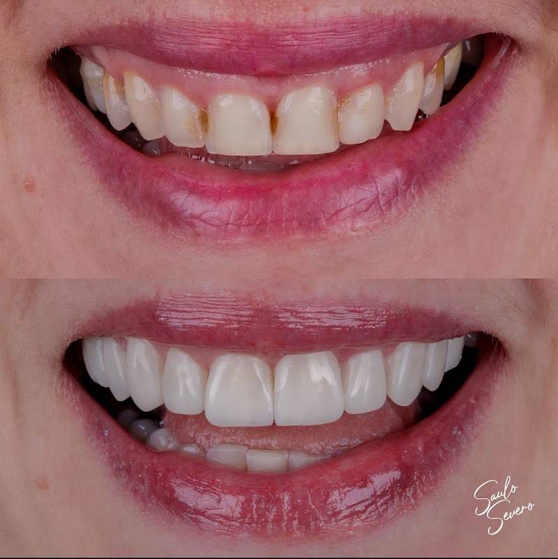 Dr. Saulo Severo Odontologia - foto 3
