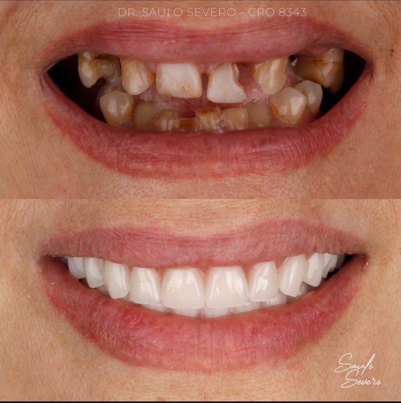 Dr. Saulo Severo Odontologia - foto 5
