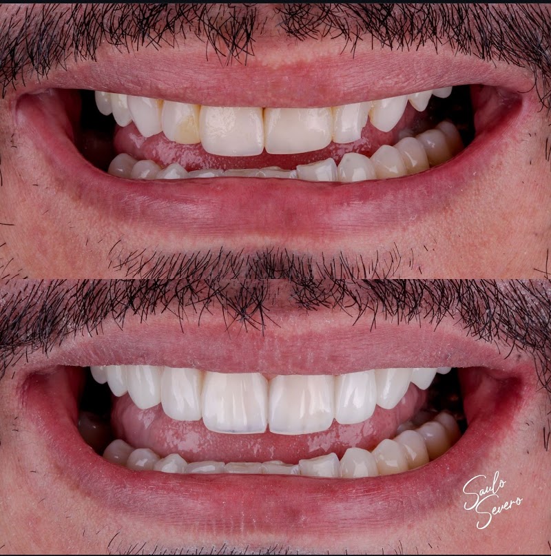 Dr. Saulo Severo Odontologia - foto 2
