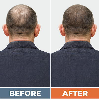 Lowcountry Male Clinic - Anderson, SC - TRT and Weight Loss Services photo 6