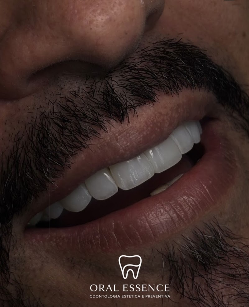 Oral Essence - foto 2