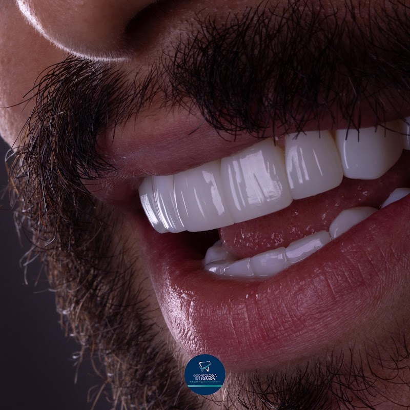 Odontologia Integrada Natal | Implante sem corte, sem dor e resultado imediato | Dentista em Natal/RN - foto 5