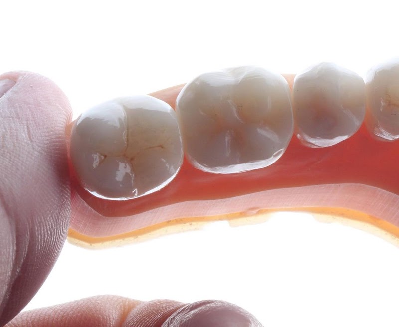 Hale Clinic | Dentista no Itaim Bibi | Invisalign, Facetas e Implantes - foto 4