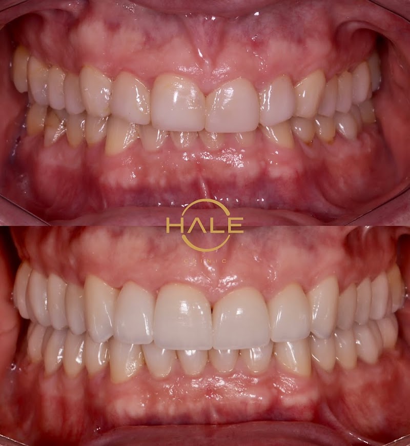 Hale Clinic | Dentista no Itaim Bibi | Invisalign, Facetas e Implantes - foto 2