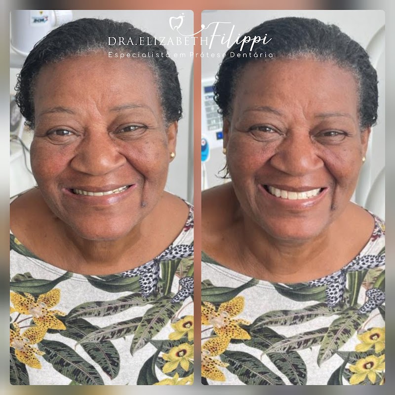 Dentista Dra. Elizabeth Filippi - foto 4