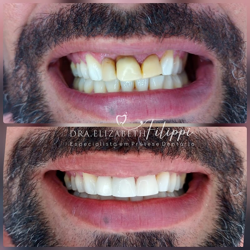 Dentista Dra. Elizabeth Filippi - foto 5