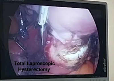 Dr. Ruchita Sinha , Best Obstetrician and Gynaecologist in jamshedpur - Image 3