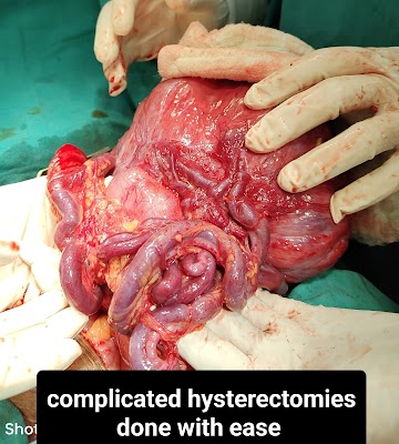 Dr. Ruchita Sinha , Best Obstetrician and Gynaecologist in jamshedpur - Image 2