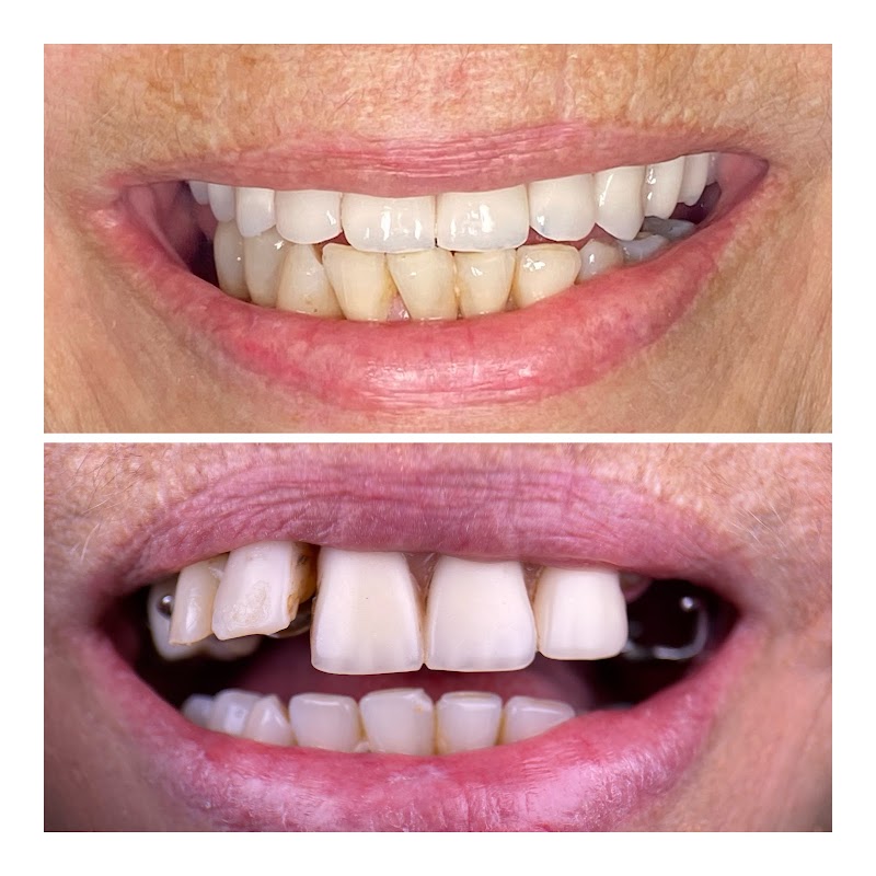 OralCenter Implantes - foto 2