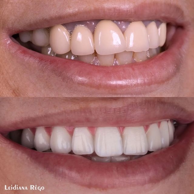 Dra. Leidiana Rêgo - foto 4