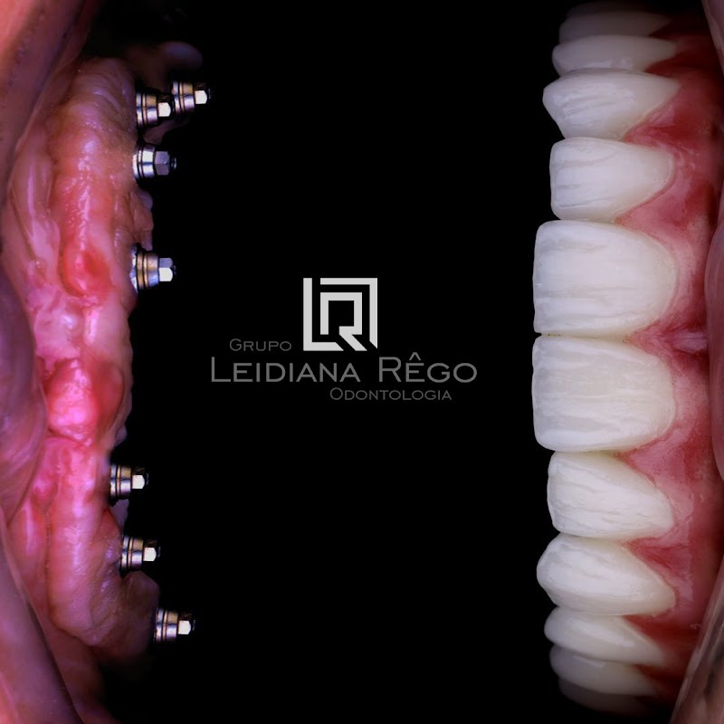 Dra. Leidiana Rêgo - foto 3