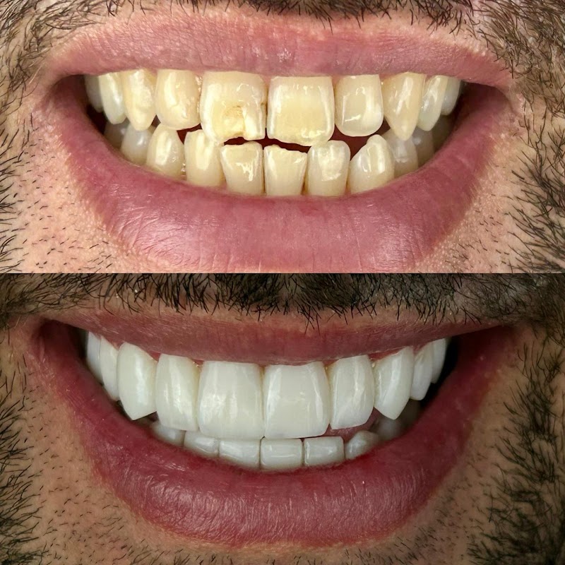 Citag Odontologia - Facetas e Implantes | Bacacheri