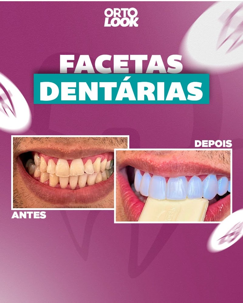 Ortolook Madureira - Clínica Odontológica - foto 4
