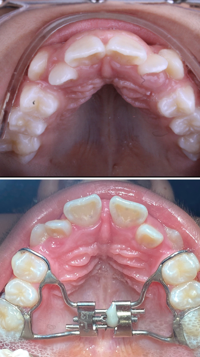 Dr. Josinaldo Filho - Dentista em João Pessoa (Ortodontista Especialista/Aparelho Dental) - foto 2