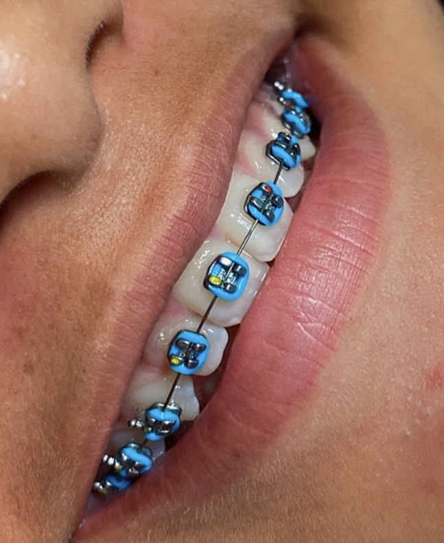 Dr. Josinaldo Filho - Dentista em João Pessoa (Ortodontista Especialista/Aparelho Dental) - foto 3