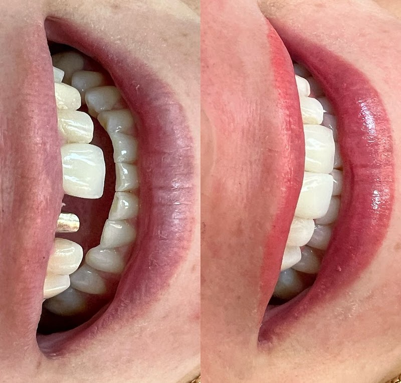 Odonto Estética e Prótese - Próteses, Implantes e Facetas em Porto Velho - foto 3