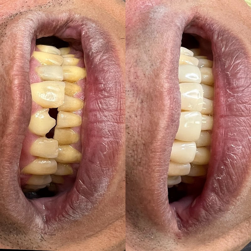 Odonto Estética e Prótese - Próteses, Implantes e Facetas em Porto Velho - foto 4