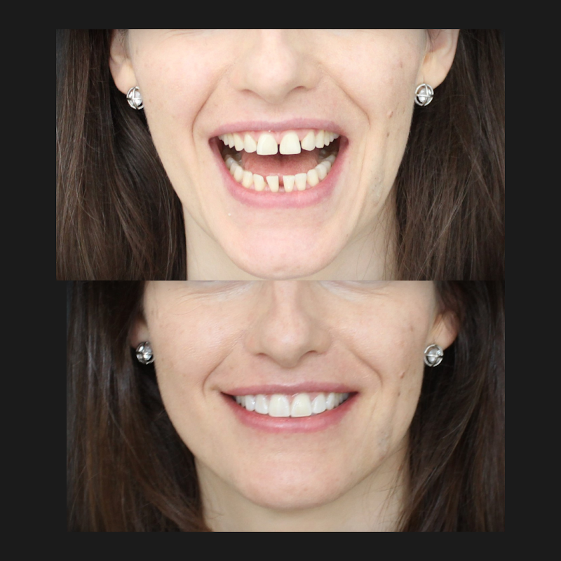 Dr. Lucas Especialista em Implantes dentários, Tratamento de canal e Potese. Dentista Cuiabá - foto 2