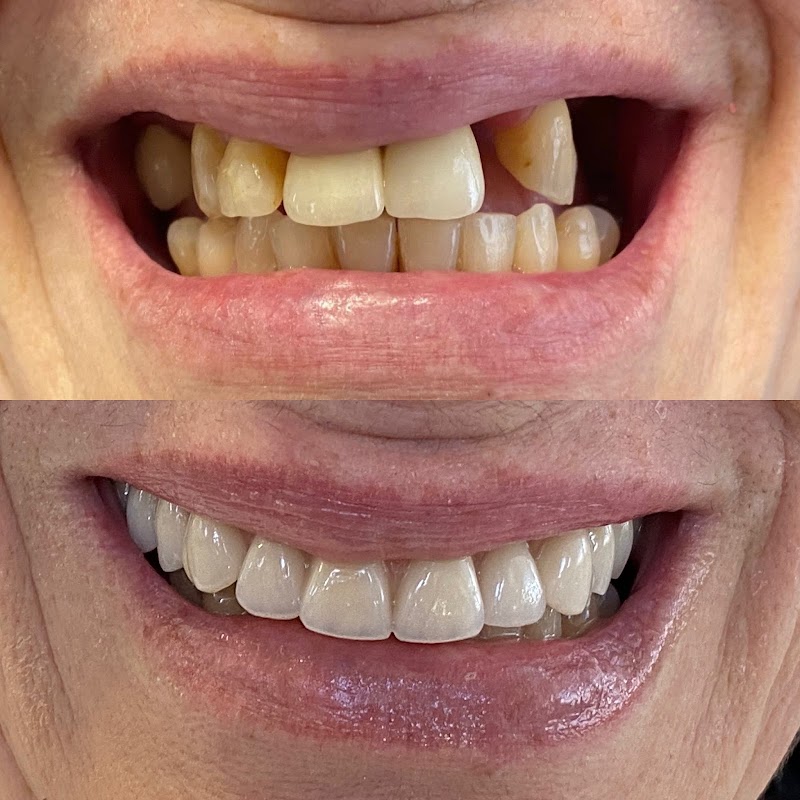 Aligner Odontologia Dra Alessandra Haliski (implante ) e Dra Sidia Coser (ortodontia) - foto 4