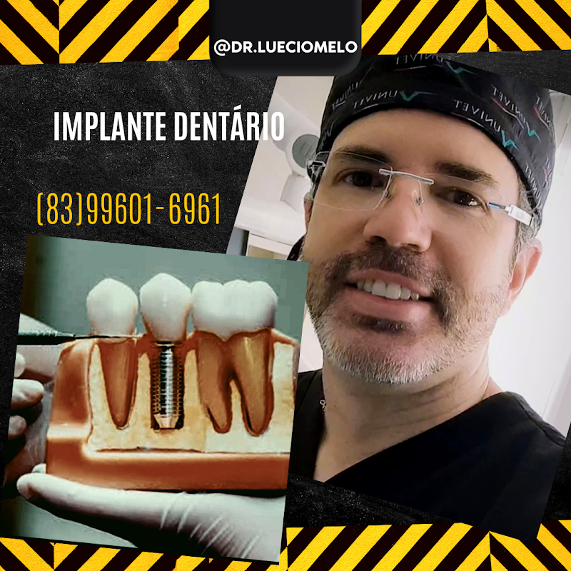 Dr. Luécio Melo - Implante Dentário - JP - foto 5