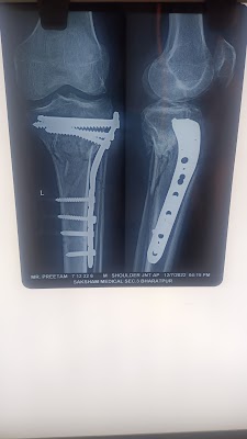 Dr Yogesh Agrawal Orthopedics & Dr Surabhi Agrawal gynecologist - Image 3