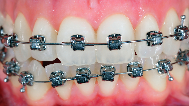 Dentista 24 horas Centro SP - Dr. Erick Andrade CRO 131.232 - foto 4