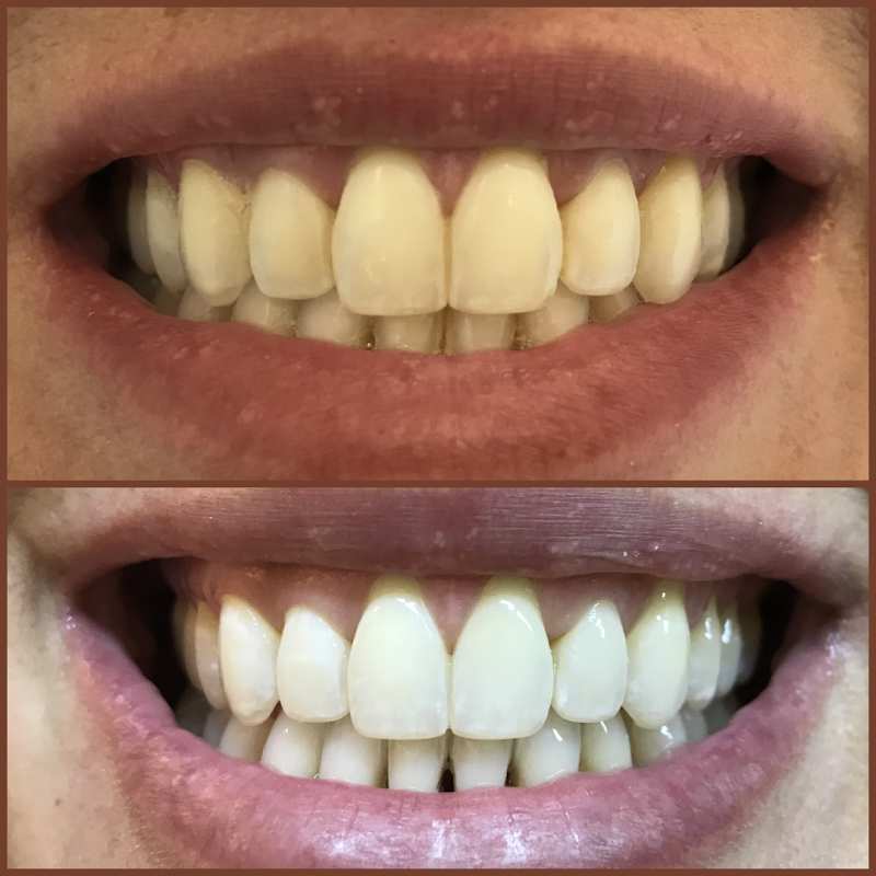 Dra. Ana Carolina Orlanda Junqueira Defina | Ortodontista Ribeirão Preto - foto 5