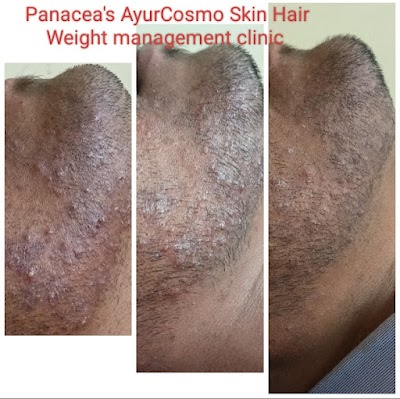Panacea Clinic (AyurCosmo SKIN | HAIR | WEIGHT MANAGEMENT). Dr Pansy P. Saldanha - Image 3