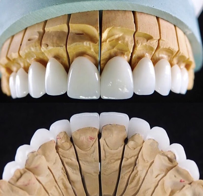 Dr. Thiago Noronha | PHD em Odontologia | Implantes Dentários | Lentes de Porcelana | Alinhadores Invisalign - foto 3