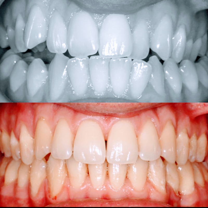 Dr. Thiago Noronha | PHD em Odontologia | Implantes Dentários | Lentes de Porcelana | Alinhadores Invisalign - foto 5