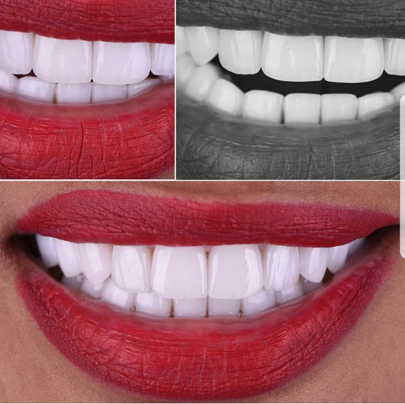 Dr. Thiago Noronha | PHD em Odontologia | Implantes Dentários | Lentes de Porcelana | Alinhadores Invisalign - foto 4