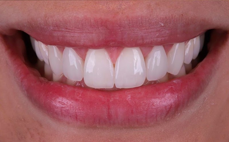 Clínica Odontológica Sorriso Mania Campinas | Dentista em Campinas - foto 5