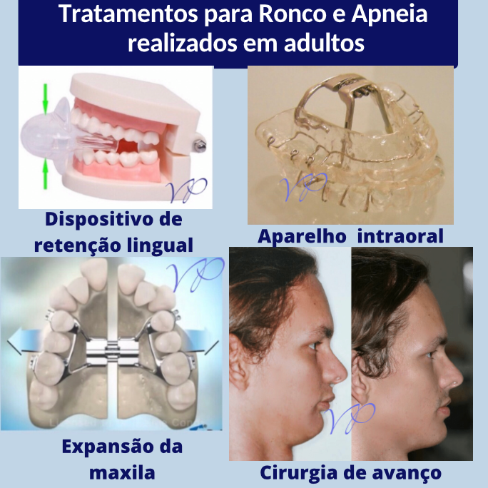 Dra Virna Patusco DTM e Dor Orofacial, Odontologia do Sono e Ortodontia - foto 4