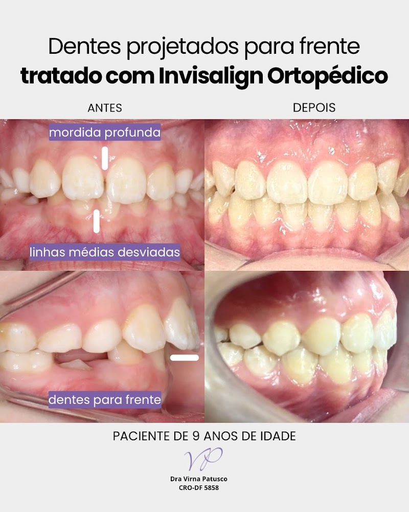 Dra Virna Patusco DTM e Dor Orofacial, Odontologia do Sono e Ortodontia