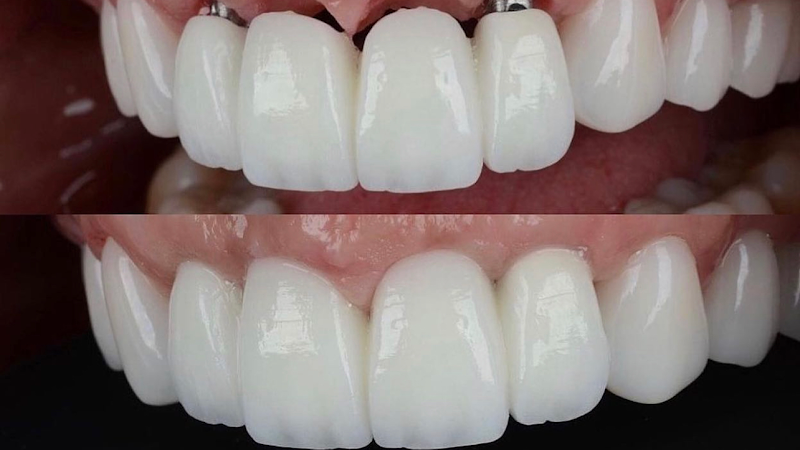 Dr. Rodolfo Bendoraytes - Dentista Implantes Dentários e Prótese Dentária Recreio dos Bandeirantes - foto 2