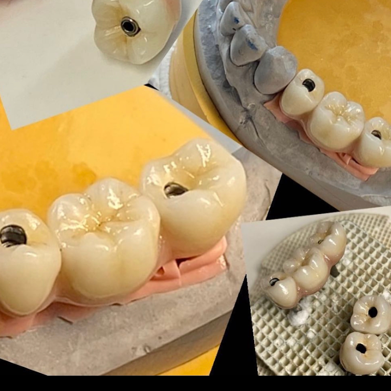 Dr. Rodolfo Bendoraytes - Dentista Implantes Dentários e Prótese Dentária Recreio dos Bandeirantes - foto 3