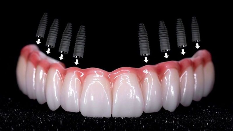 Dr. Rodolfo Bendoraytes - Dentista Implantes Dentários e Prótese Dentária Recreio dos Bandeirantes - foto 1