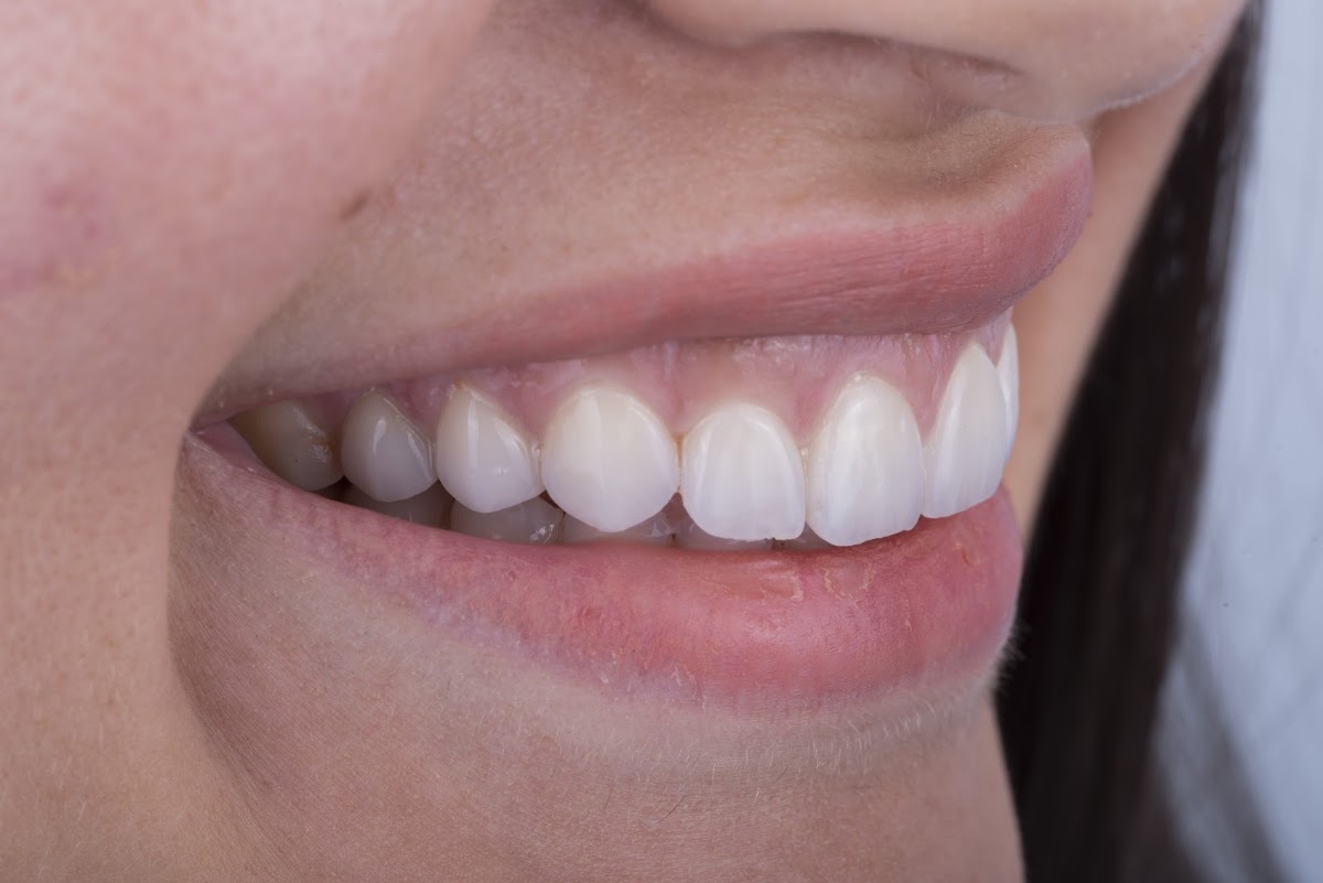 Ora Dental Clinic 5