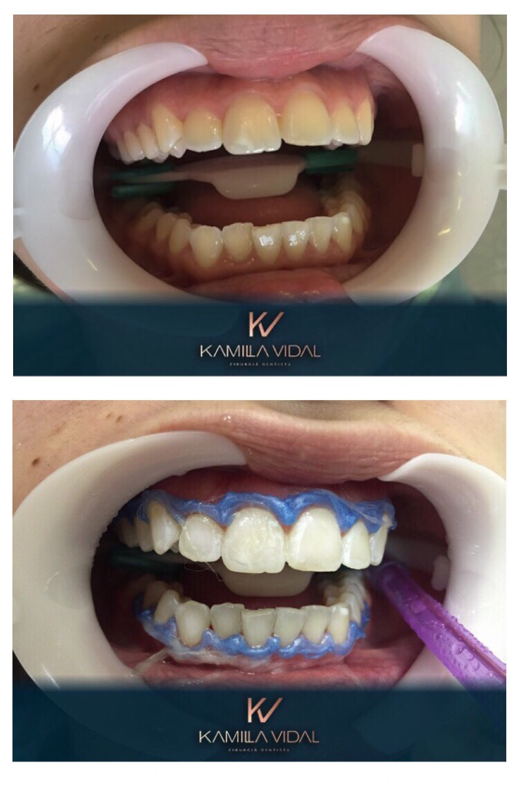 Dra Kamilla Vidal - Dentista - foto 4