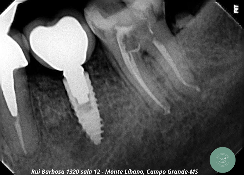 Dra. Estéfani Sartori Kuss | Endodontia | Clínica Geral | Campo Grande MS - foto 5