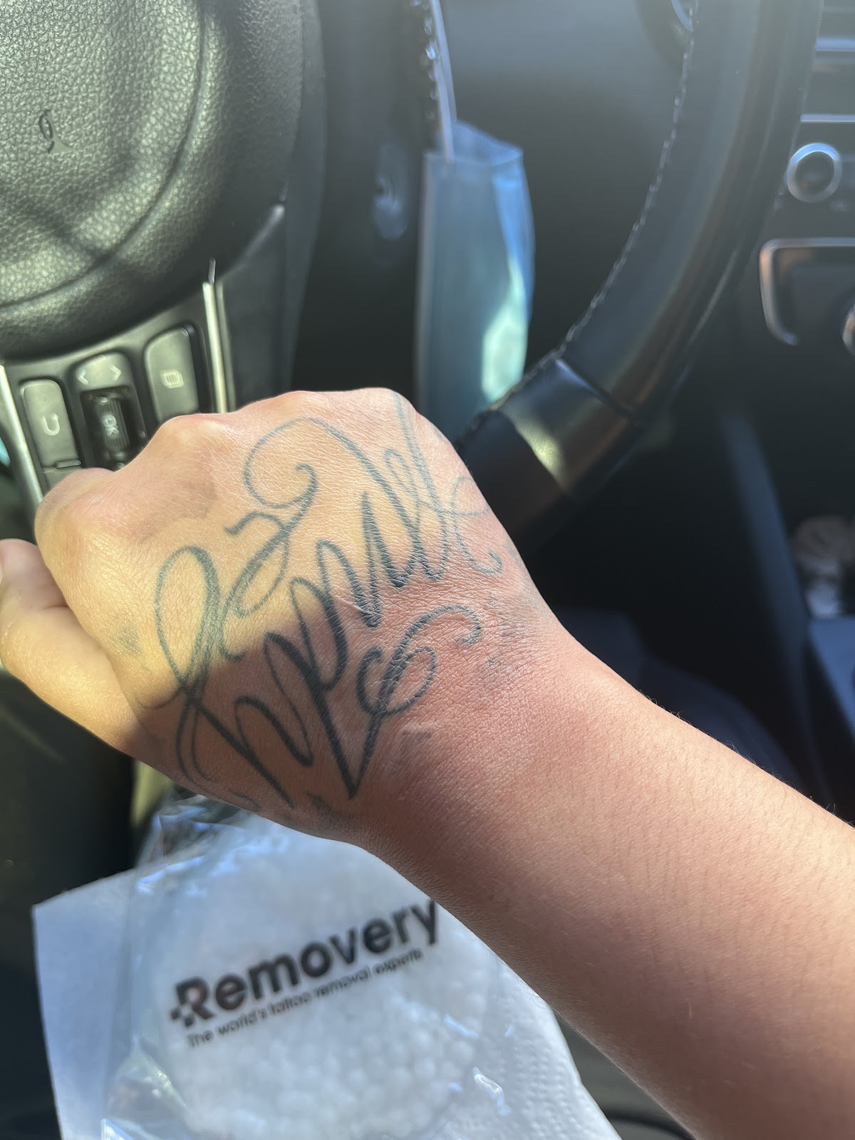 Removery Tattoo Removal & Fading tattoo work — photo 2