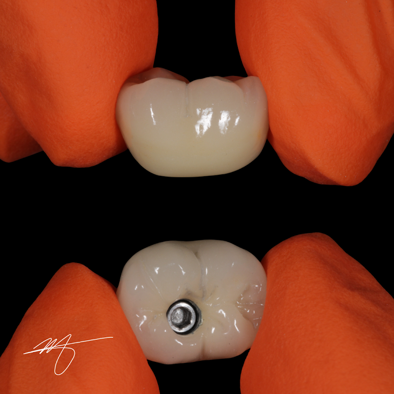 Dra. Maria Eduarda Bernardo | Dentista Sul da Ilha | Campeche - foto 3