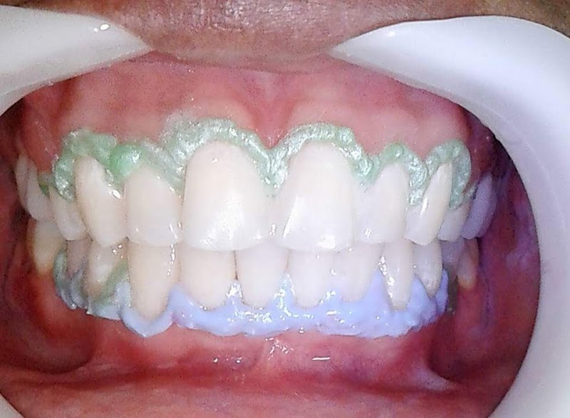 Dr Erival Santana - Dentista 24 HS - foto 5