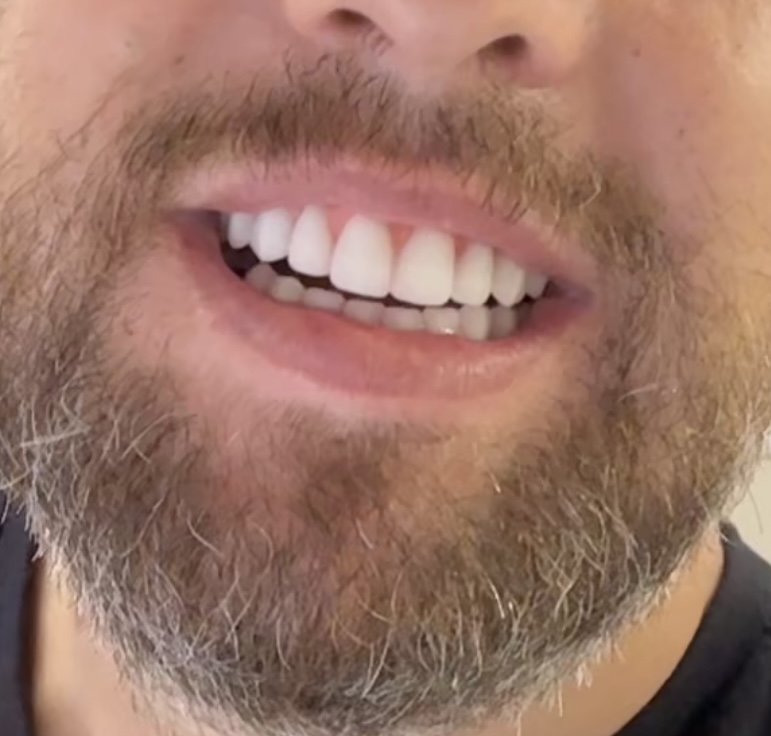 Odonto Implantes - foto 4