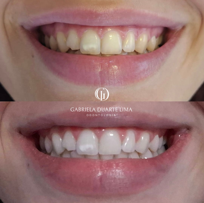 Dra. Gabriela Duarte – Dentista em Campinas - foto 4