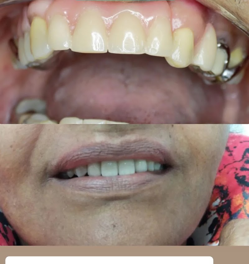 Dr. Geraldo Prisco | Implantes dentário | Extração | Clareamento - foto 2